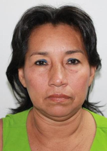 Alvarez Alvan Silma del Carmen