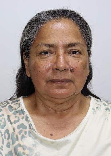 Guerra Teixeira Aldi Alida