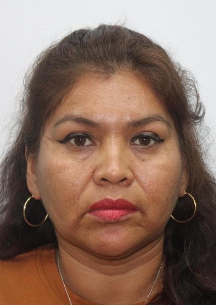 Vicuña Carpio Teodora Roxana