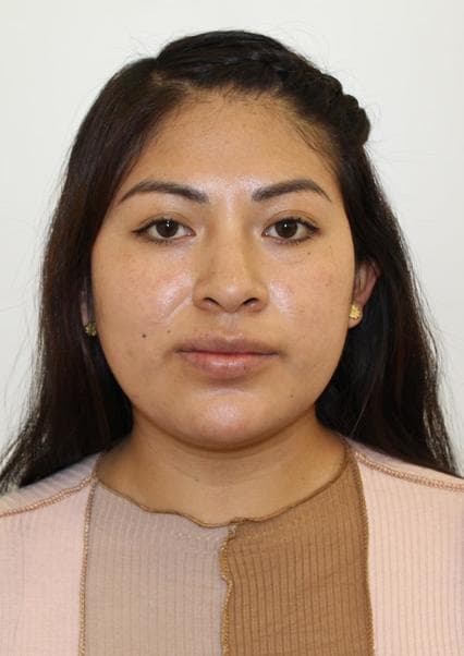 Limascca Ninacondo Milagros