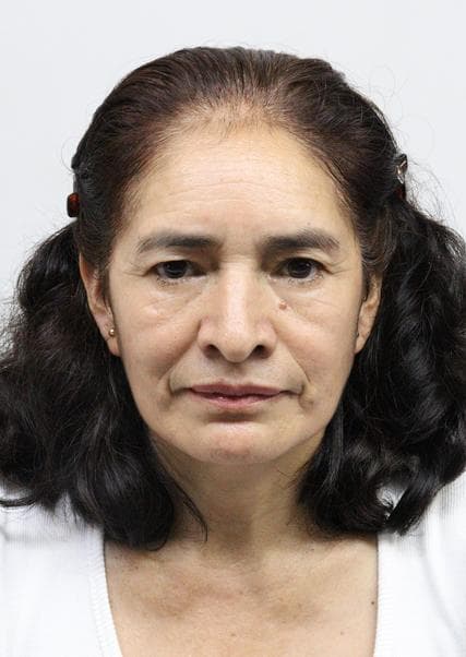 Nuñez Chachapoyas Elvia